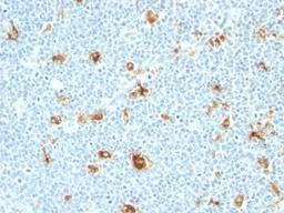 Formalin-fixed, paraffin-embedded human tonsil stained with Calgranulin A + B antibody (CAGB/426)