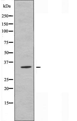 Western blot analysis of Jurkat cells using OR5AU1 antibody