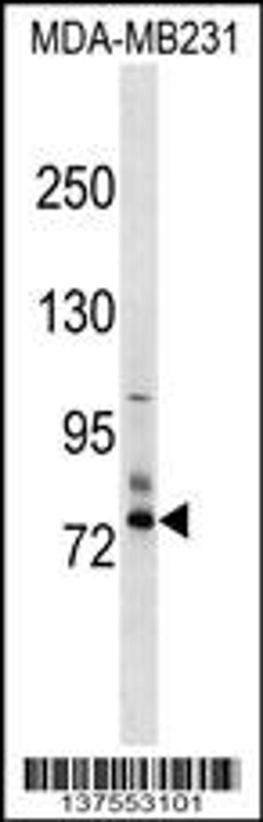 Western blot analysis in MDA-MB231 cell line lysates (35ug/lane).