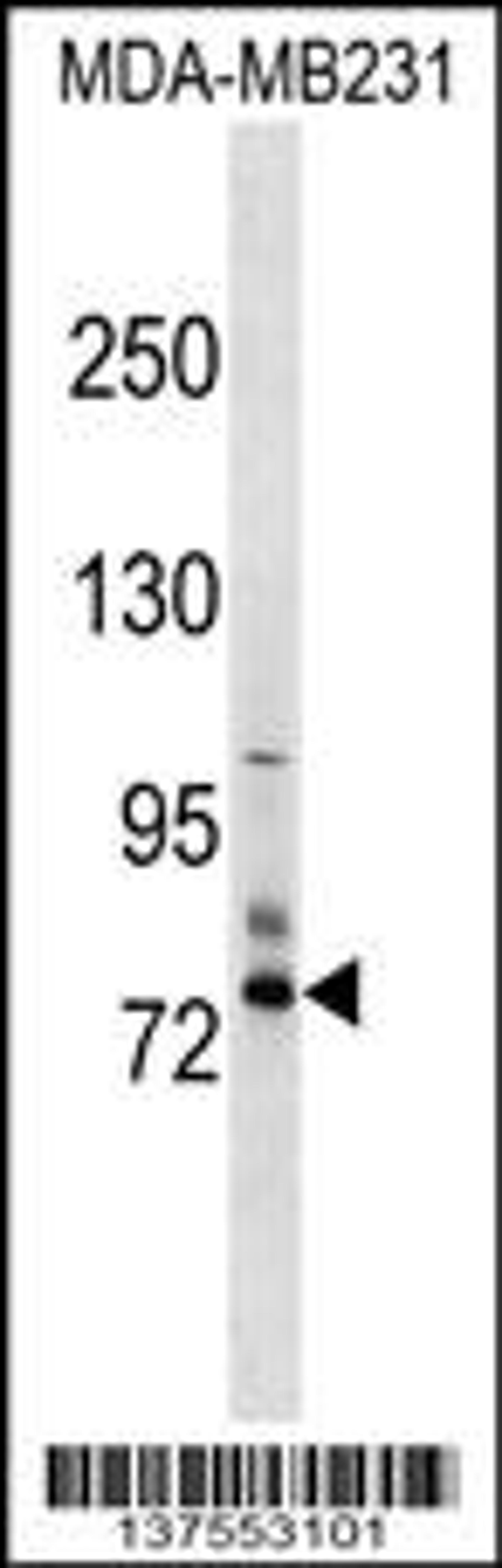 Western blot analysis in MDA-MB231 cell line lysates (35ug/lane).