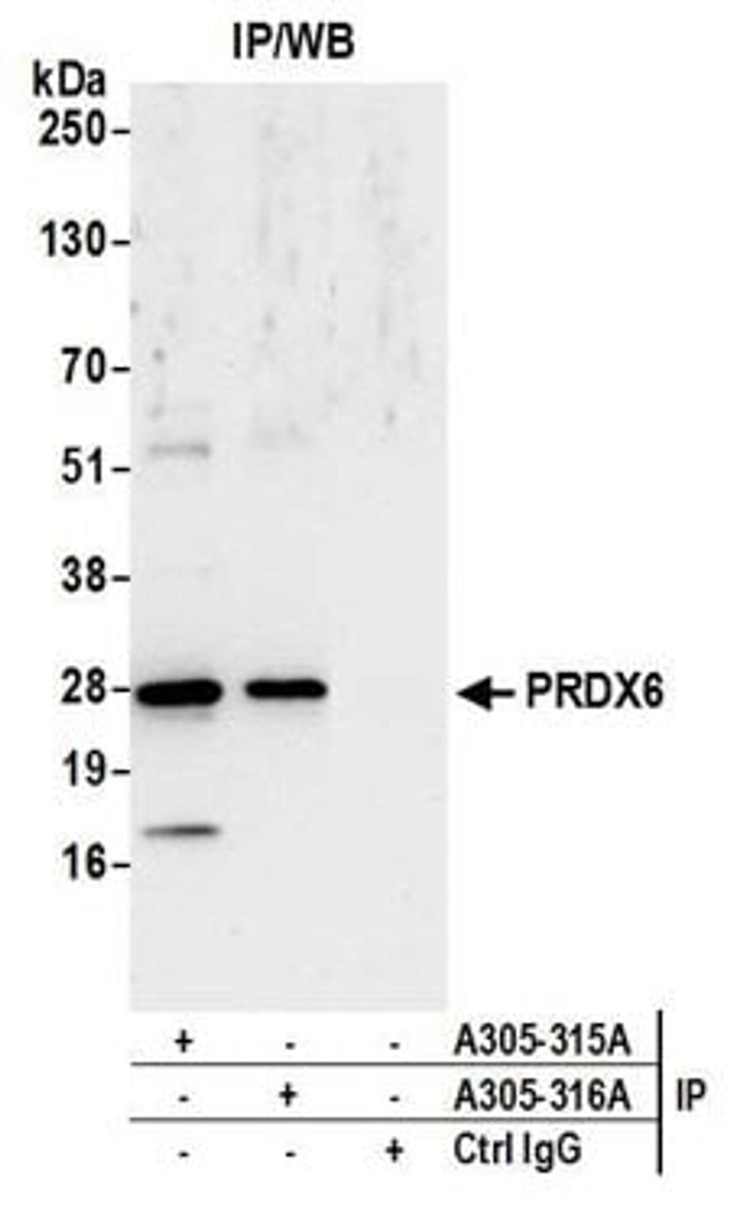 Detection of human PRDX6 by western blot of immunoprecipitates.