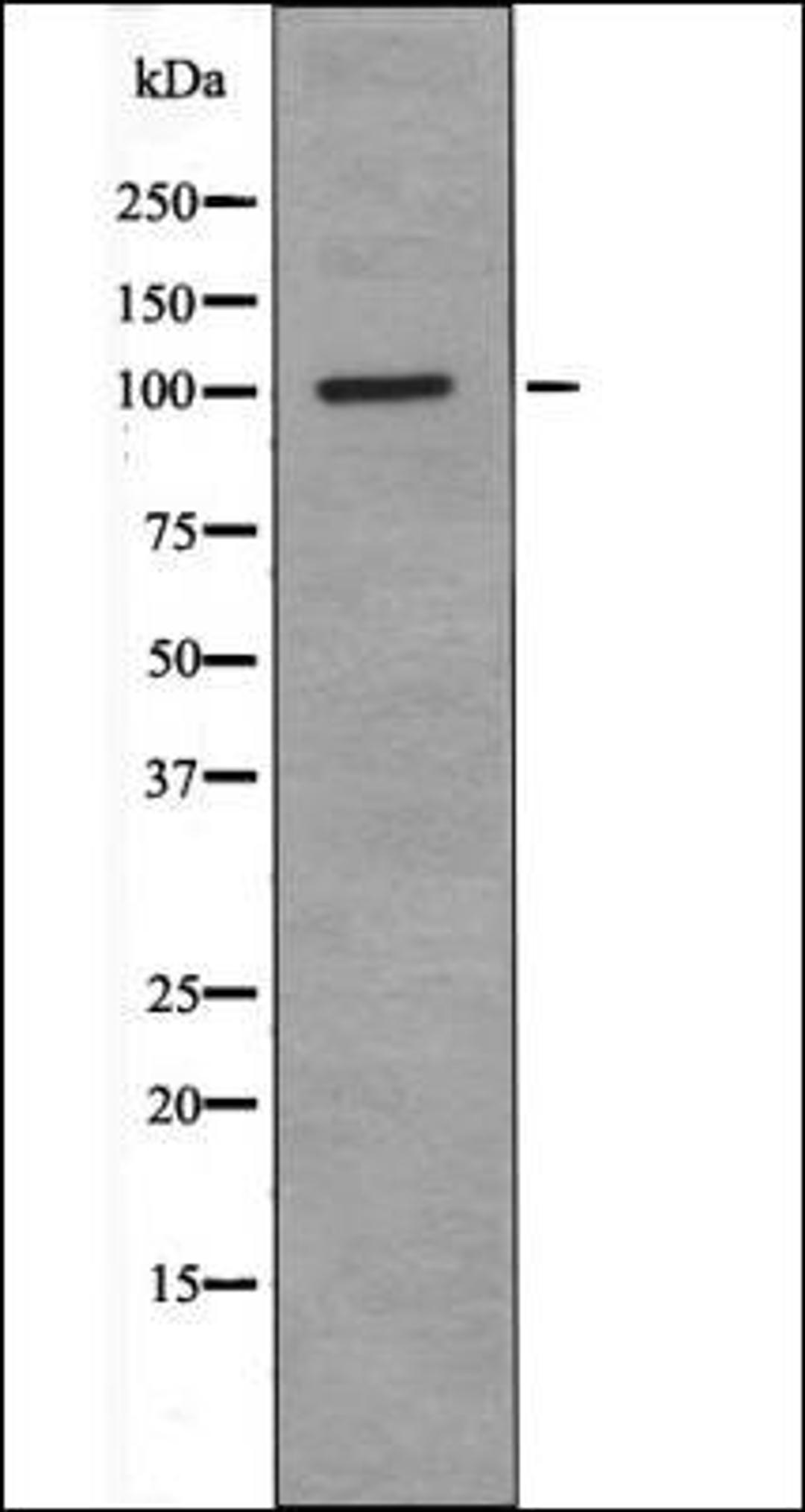 Western blot analysis of NIH-3T3 whole cell lysates using RBBP8 -Phospho-Ser664- antibody