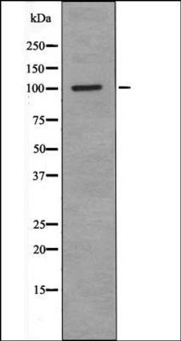 Western blot analysis of NIH-3T3 whole cell lysates using RBBP8 -Phospho-Ser664- antibody