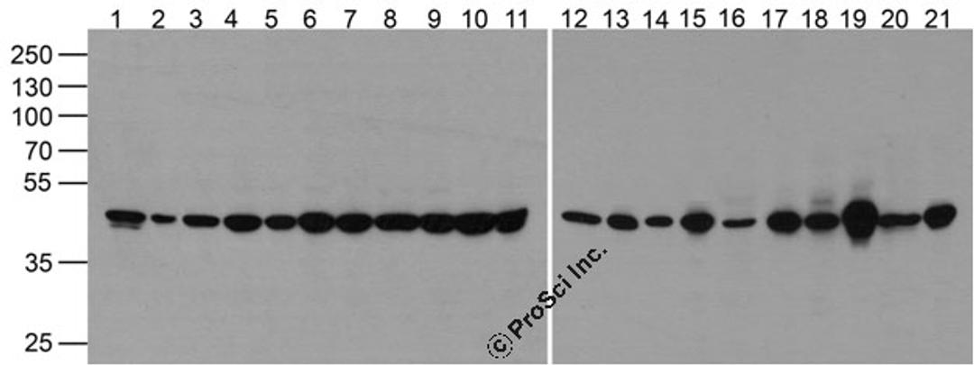 Western blot of beta-Actin in 293, A431, HepG2, Jurkat, K562, MOLT, 3T3, Raji, Ramos, THP-1, U937, human brain, mouse brain, rat brain, rabbit brain, rat liver, rabbit spleen, chicken liver, chicken small intestine, zebrafish, and drosophila lysate at 1 &