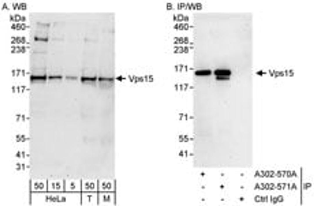 Detection of human and mouse Vps15 by western blot (h&m) and immunoprecipitation (h).