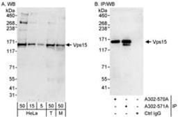 Detection of human and mouse Vps15 by western blot (h&m) and immunoprecipitation (h).