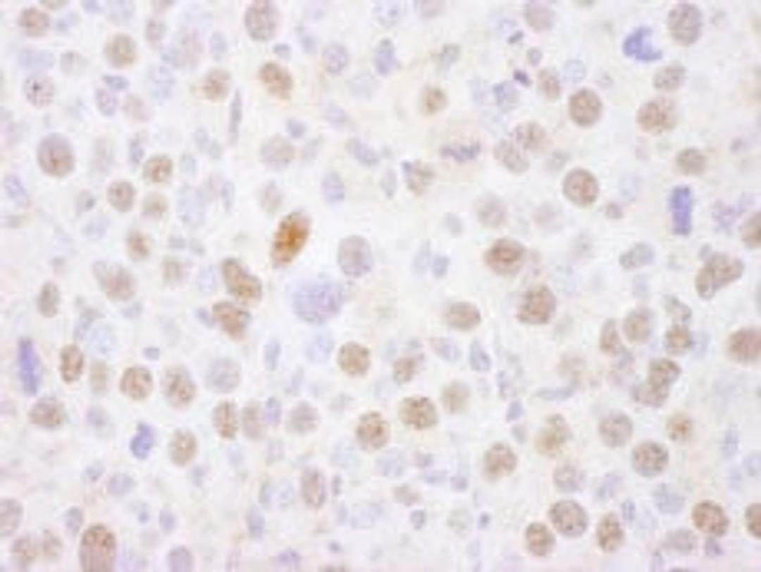 Detection of mouse MEF2A by immunohistochemistry.