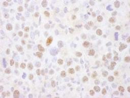 Detection of mouse MEF2A by immunohistochemistry.