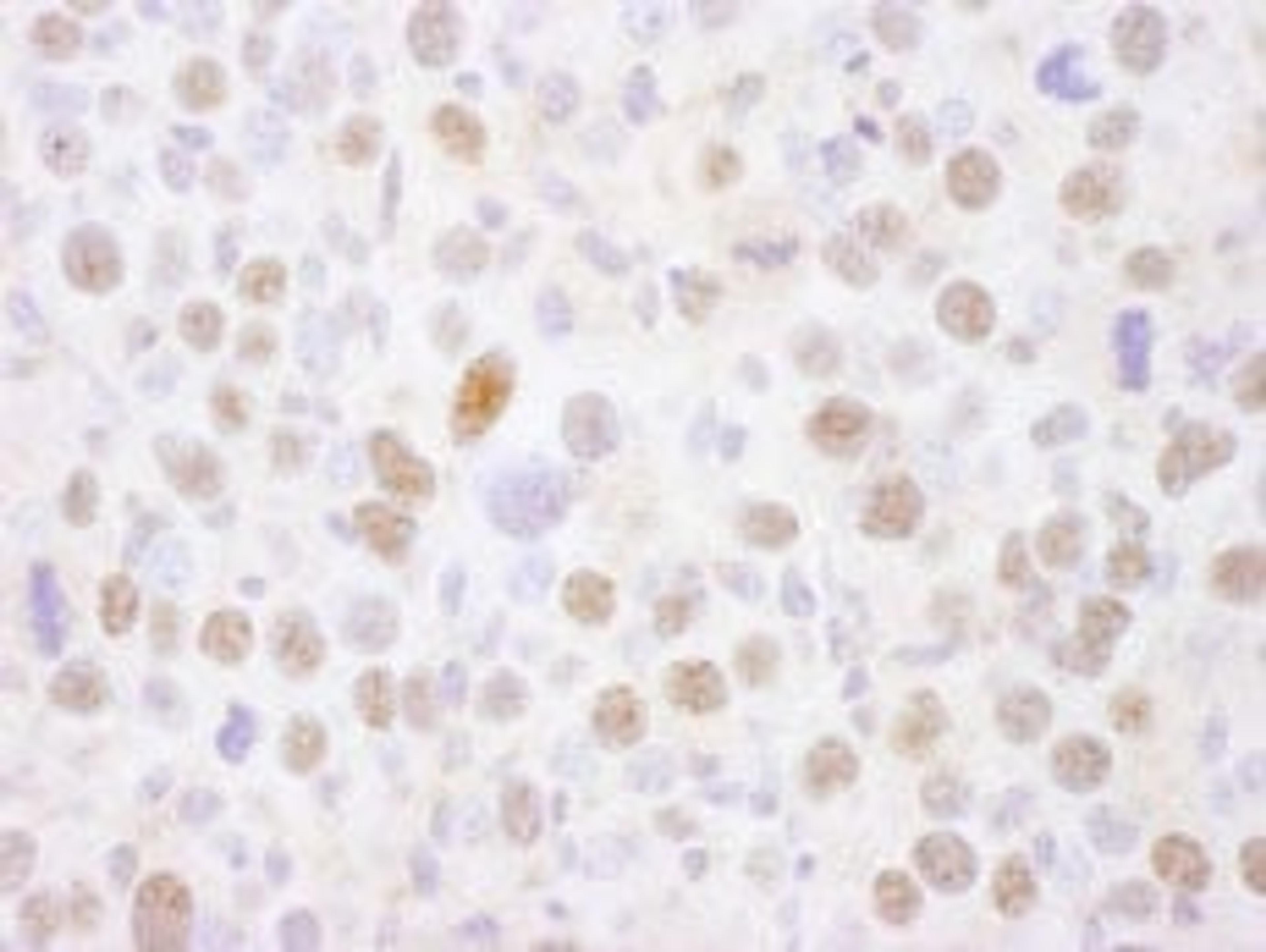 Detection of mouse MEF2A by immunohistochemistry.