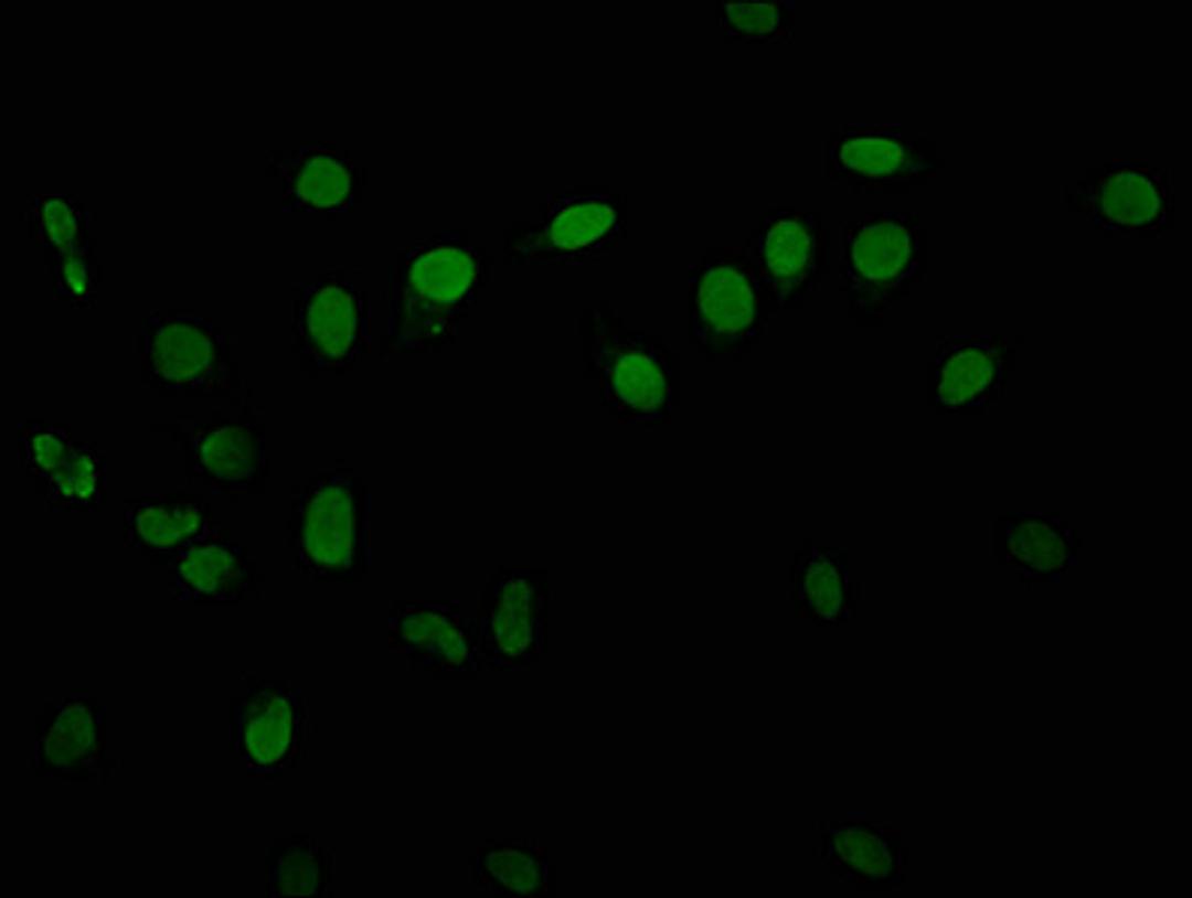 Immunofluorescence staining of Hela cells with CSB-PA010418OA06phHU at 1:10, counter-stained with DAPI. The cells were fixed in 4% formaldehyde, permeabilized using 0.2% Triton X-100 and blocked in 10% normal Goat Serum. The cells were then incubated with the antibody overnight at 4&deg;C. The secondary antibody was Alexa Fluor 488-congugated AffiniPure Goat Anti-Rabbit IgG(H+L).