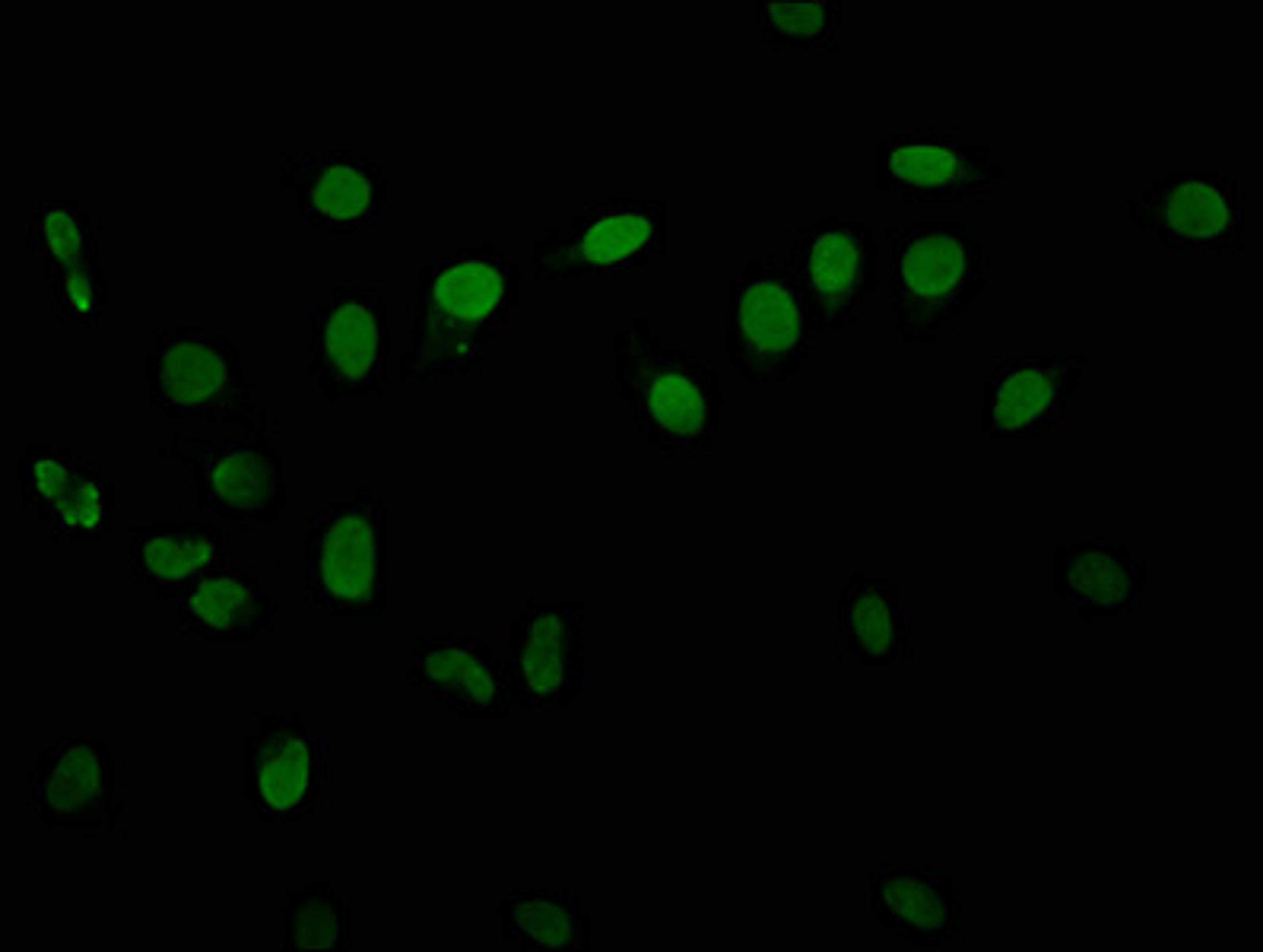 Immunofluorescence staining of Hela cells with CSB-PA010418OA06phHU at 1:10, counter-stained with DAPI. The cells were fixed in 4% formaldehyde, permeabilized using 0.2% Triton X-100 and blocked in 10% normal Goat Serum. The cells were then incubated with the antibody overnight at 4&deg;C. The secondary antibody was Alexa Fluor 488-congugated AffiniPure Goat Anti-Rabbit IgG(H+L).