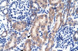 Antibody used in IHC on Human kidney.