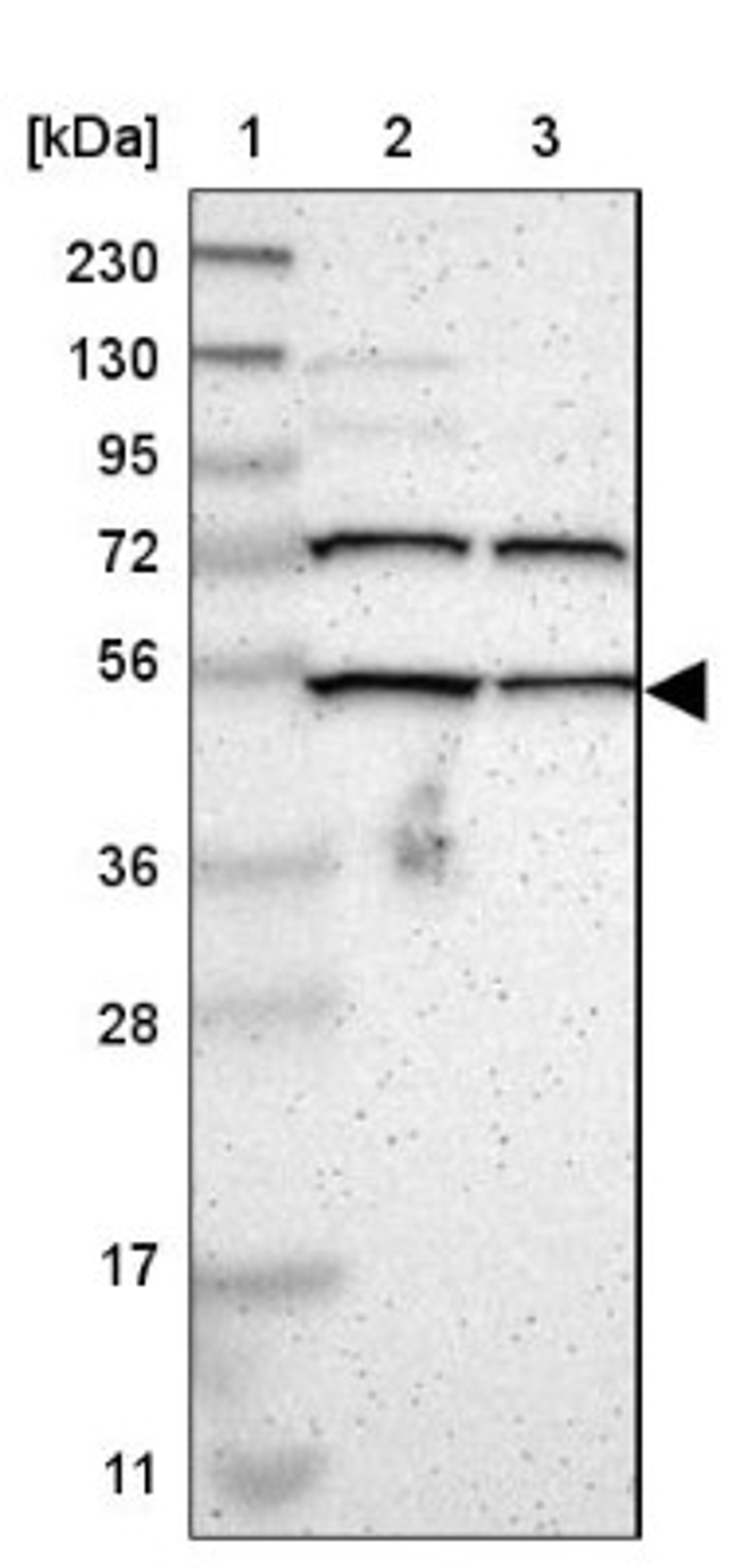 Western Blot: KIAA0494 Antibody [NBP1-86098] - Lane 1: Marker [kDa] 230, 130, 95, 72, 56, 36, 28, 17, 11<br/>Lane 2: Human cell line RT-4<br/>Lane 3: Human cell line U-251MG sp