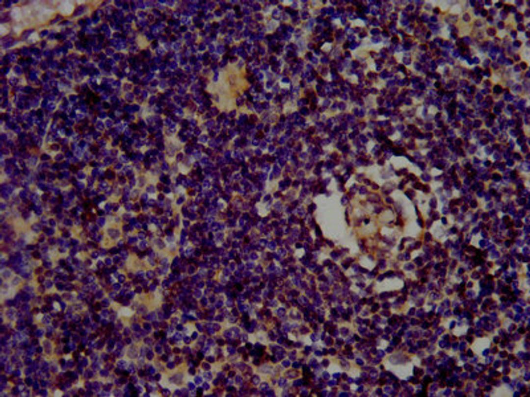 IHC image of CSB-PA22679A0Rb diluted at 1:400 and staining in paraffin-embedded human lymph node tissue performed on a Leica BondTM system. After dewaxing and hydration, antigen retrieval was mediated by high pressure in a citrate buffer (pH 6.0). Section was blocked with 10% normal goat serum 30min at RT. Then primary antibody (1% BSA) was incubated at 4°C overnight. The primary is detected by a biotinylated secondary antibody and visualized using an HRP conjugated SP system.