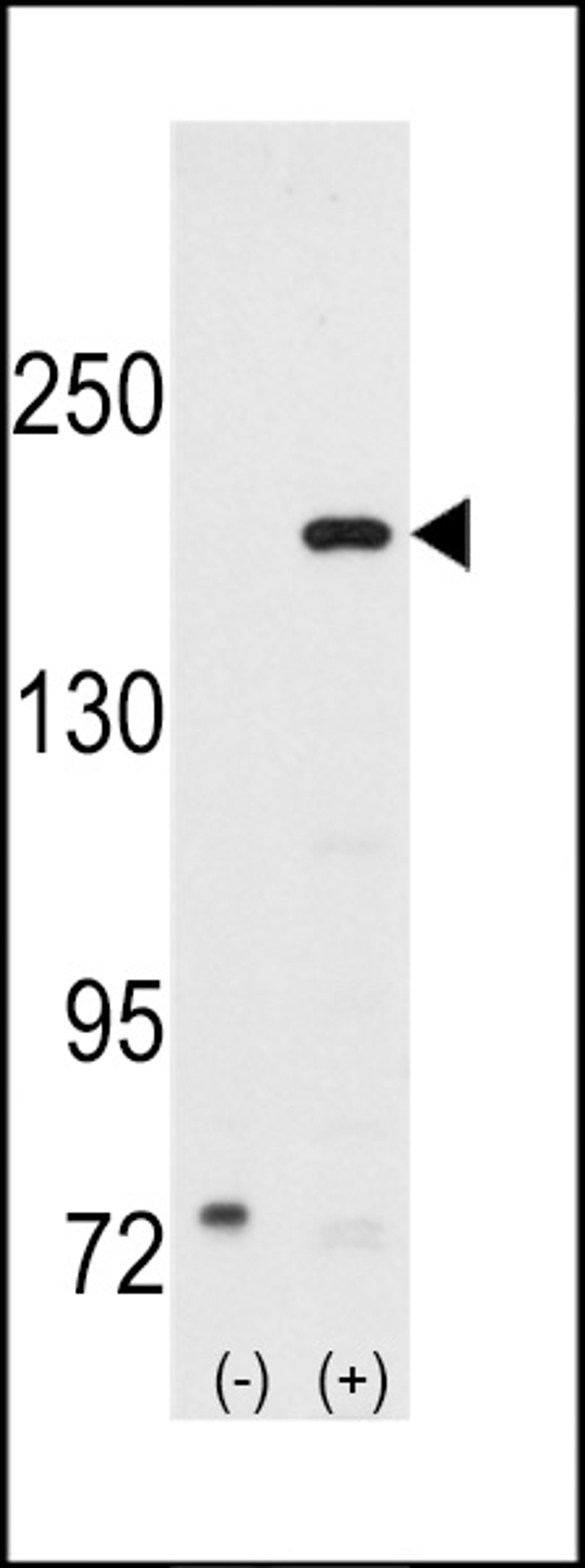 Western blot analysis of SRC1 using rabbit polyclonal SRC1 Antibody using 293 cell lysates (2 ug/lane) either nontransfected (Lane 1) or transiently transfected with the SRC1 gene (Lane 2).