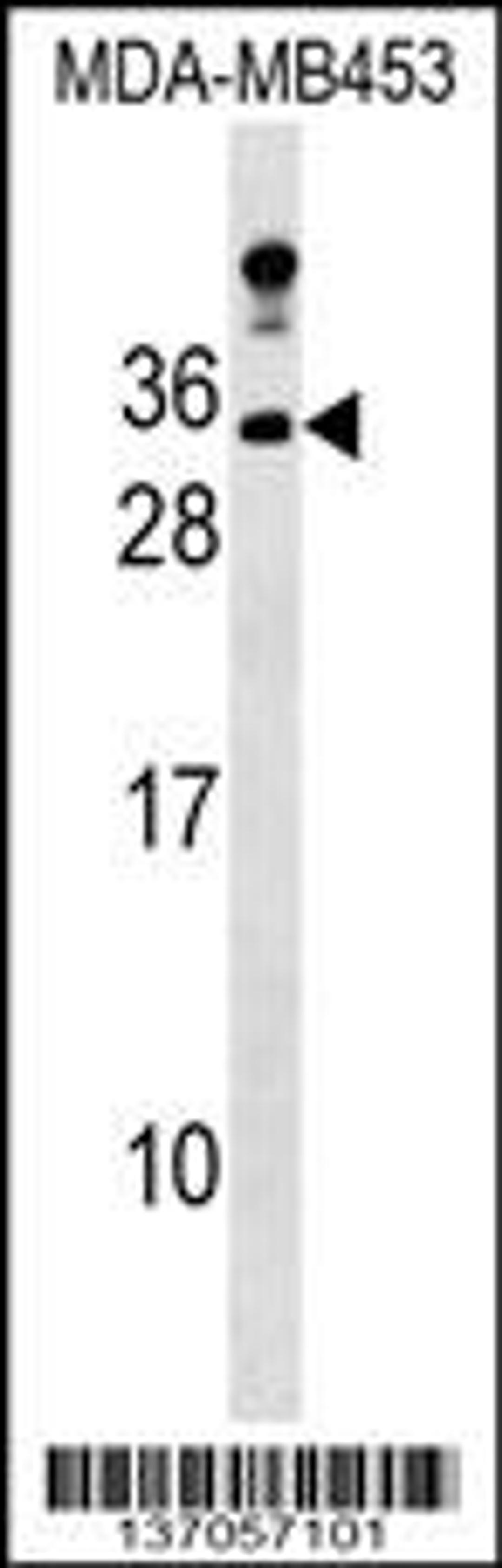 Western blot analysis in MDA-MB453 cell line lysates (35ug/lane).