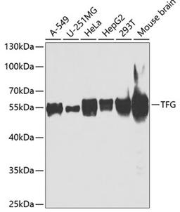 Western blot - TFG antibody (A7769)