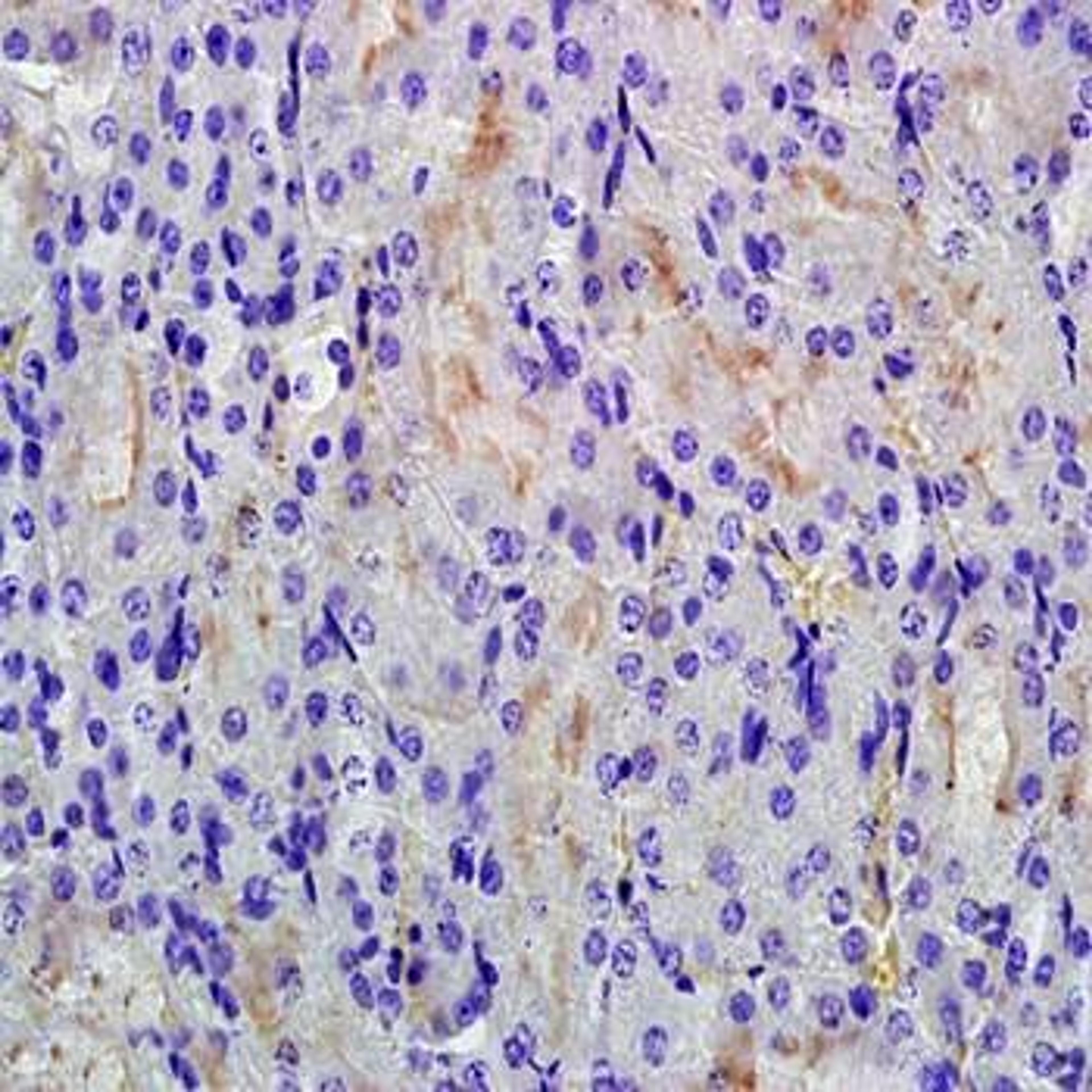 Immunohistochemical analysis of formalin-fixed and paraffin embedded mouse kidney tissue (dilution at 1:200) using RHCG antibody