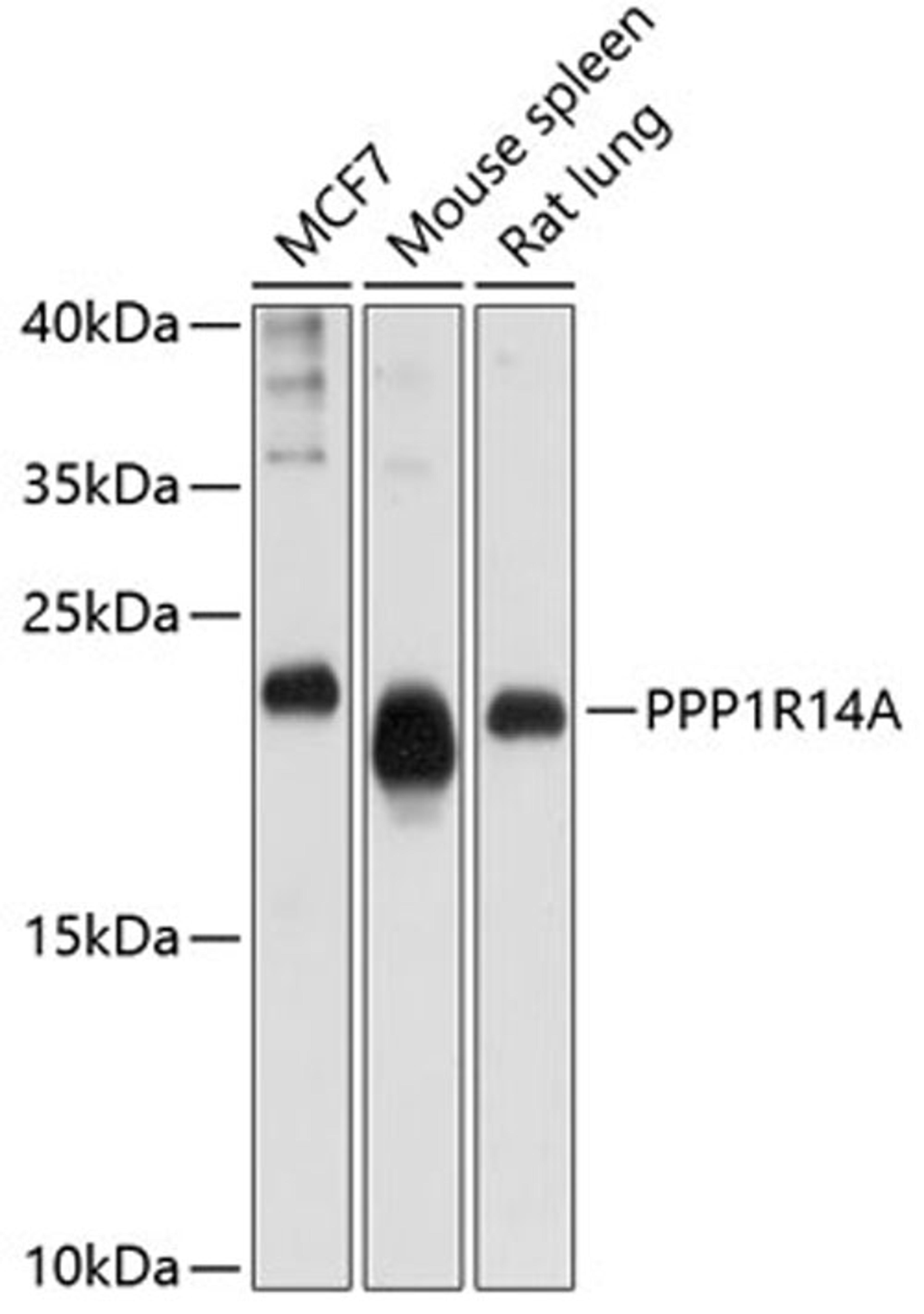 Western blot - PPP1R14A antibody (A10160)