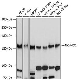 Western blot - NOMO1 antibody (A10510)