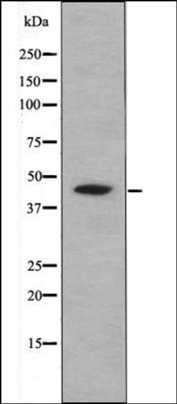 Western blot analysis of Starvation treated K562 whole cell lysates using CREB -Phospho-Ser111- antibody