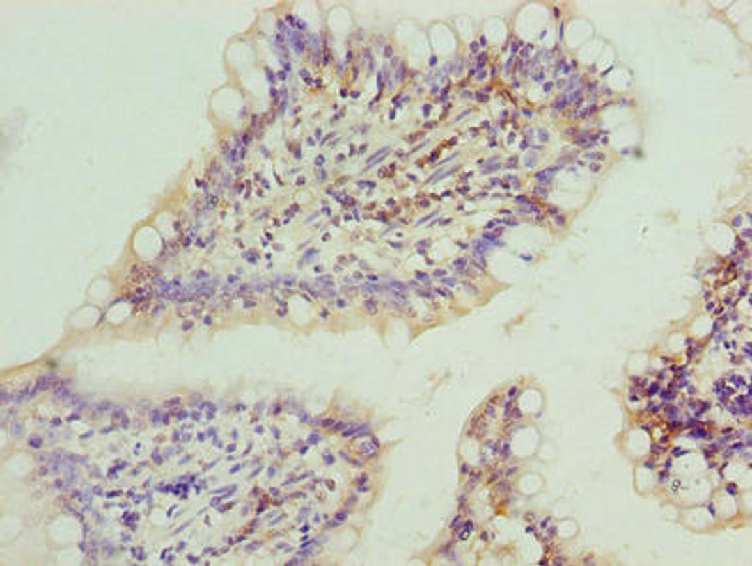 Immunohistochemistry of paraffin-embedded human small intestine tissue using CSB-PA822239LA01HU at dilution of 1:100