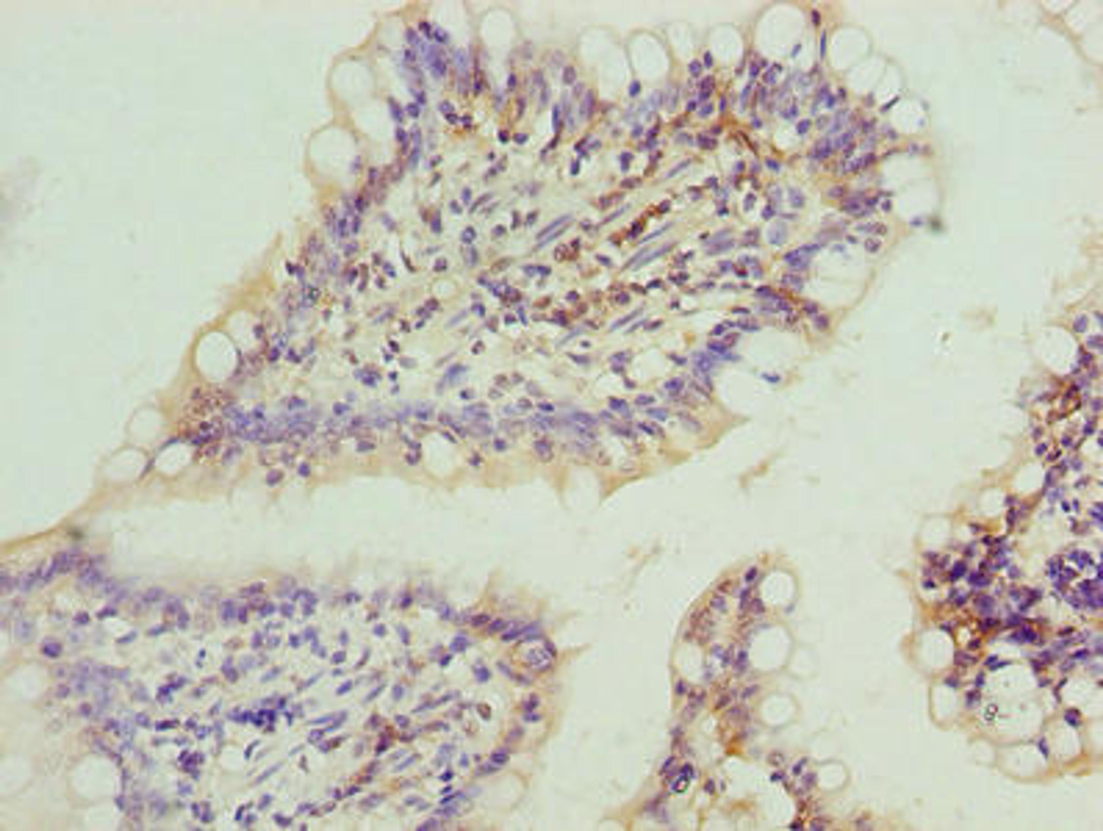 Immunohistochemistry of paraffin-embedded human small intestine tissue using CSB-PA822239LA01HU at dilution of 1:100
