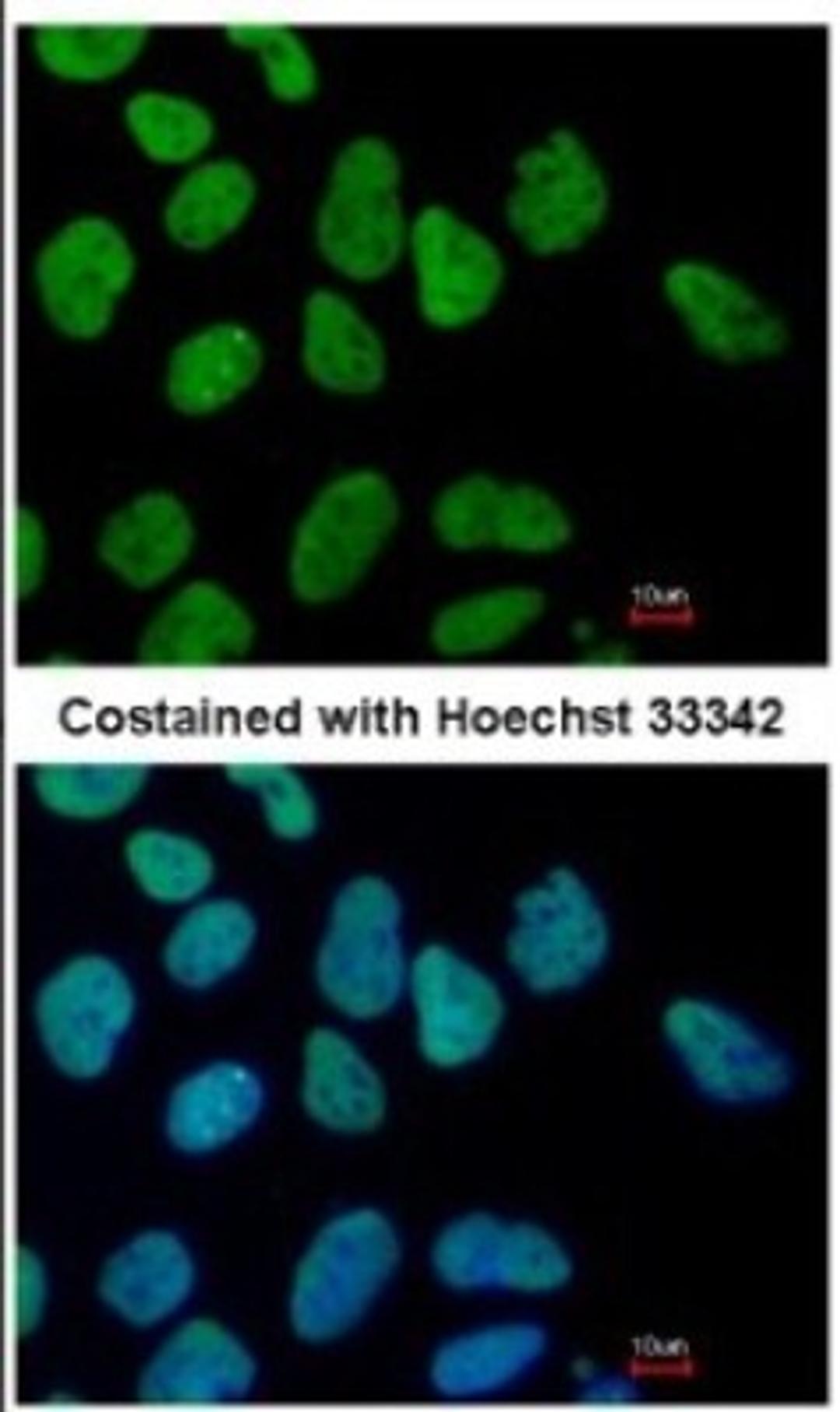 Immunocytochemistry/Immunofluorescence: Sall4 Antibody [NBP1-32969] - Paraformaldehyde-fixed Human ESC, using SALL4 antibody at 1:400 dilution.