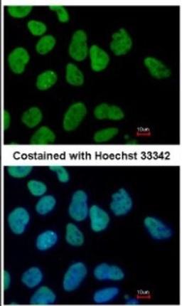 Immunocytochemistry/Immunofluorescence: Sall4 Antibody [NBP1-32969] - Paraformaldehyde-fixed Human ESC, using SALL4 antibody at 1:400 dilution.