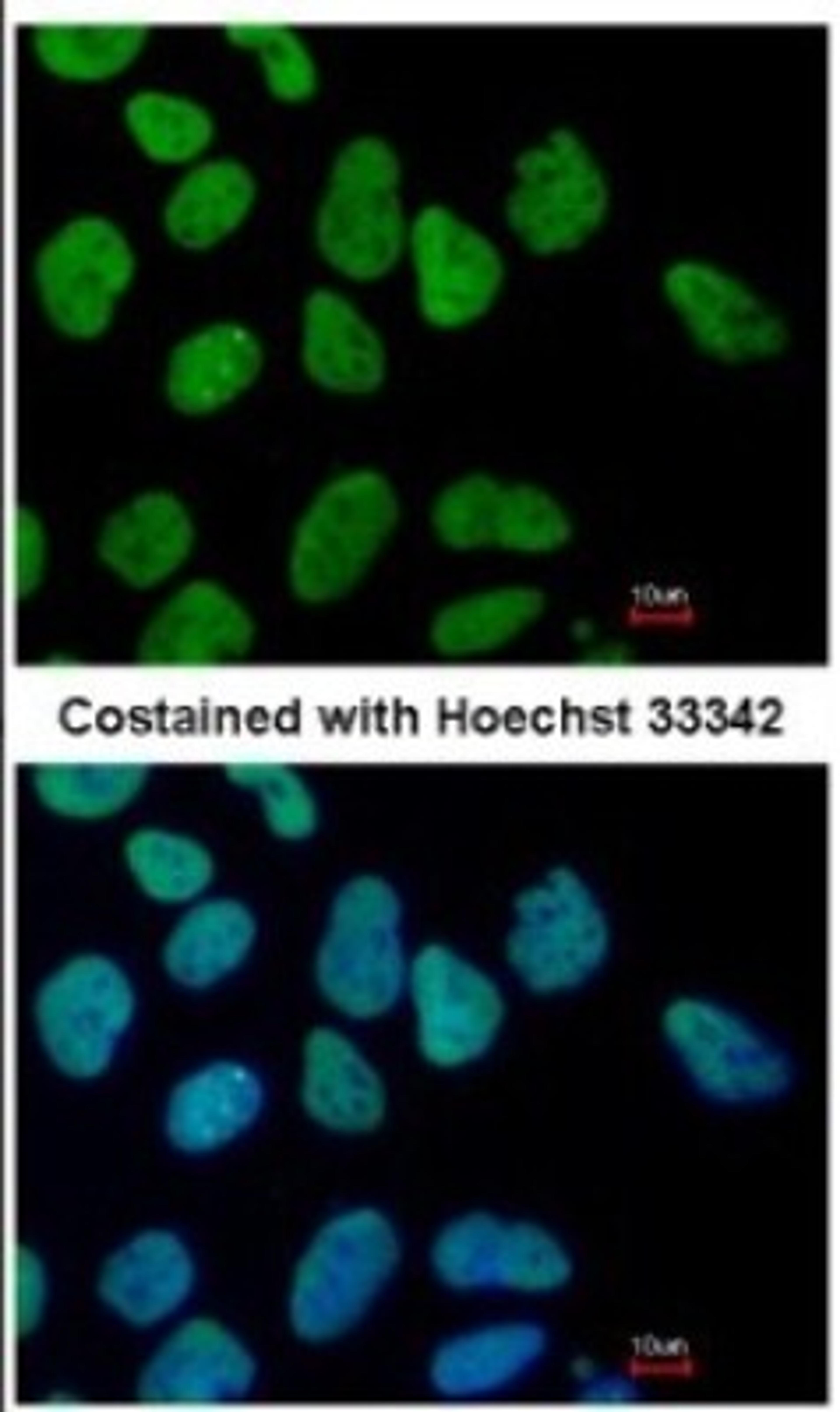 Immunocytochemistry/Immunofluorescence: Sall4 Antibody [NBP1-32969] - Paraformaldehyde-fixed Human ESC, using SALL4 antibody at 1:400 dilution.