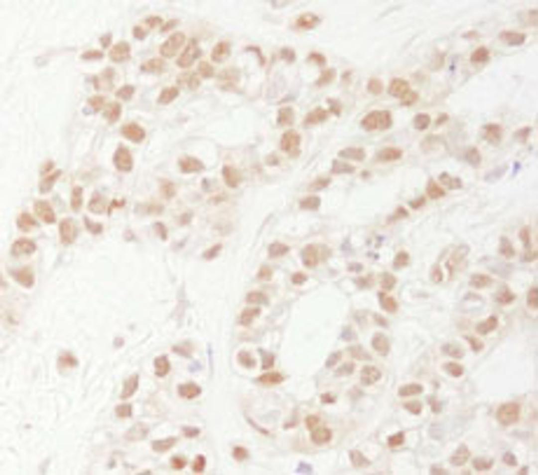 Detection of human Rad9 by immunohistochemistry.