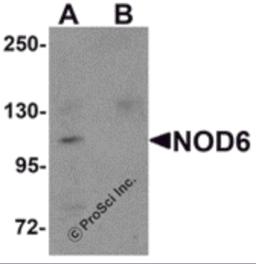 Western blot analysis of NOD6 in EL4 cell lysate with NOD6 antibody at 1 &#956;g/mL in the (A) absence and (B) presence of blocking peptide.