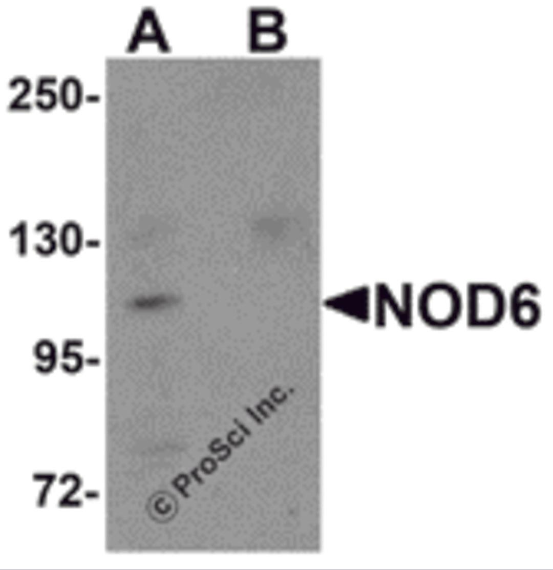 Western blot analysis of NOD6 in EL4 cell lysate with NOD6 antibody at 1 μg/mL in the (A) absence and (B) presence of blocking peptide.