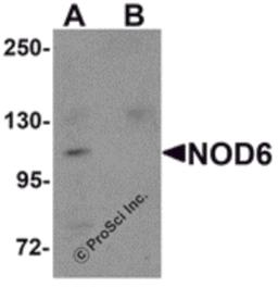 Western blot analysis of NOD6 in EL4 cell lysate with NOD6 antibody at 1 μg/mL in the (A) absence and (B) presence of blocking peptide.