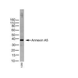 Human tonsil lysate probed with Rabbit anti Human Annexin V (AHP1924)