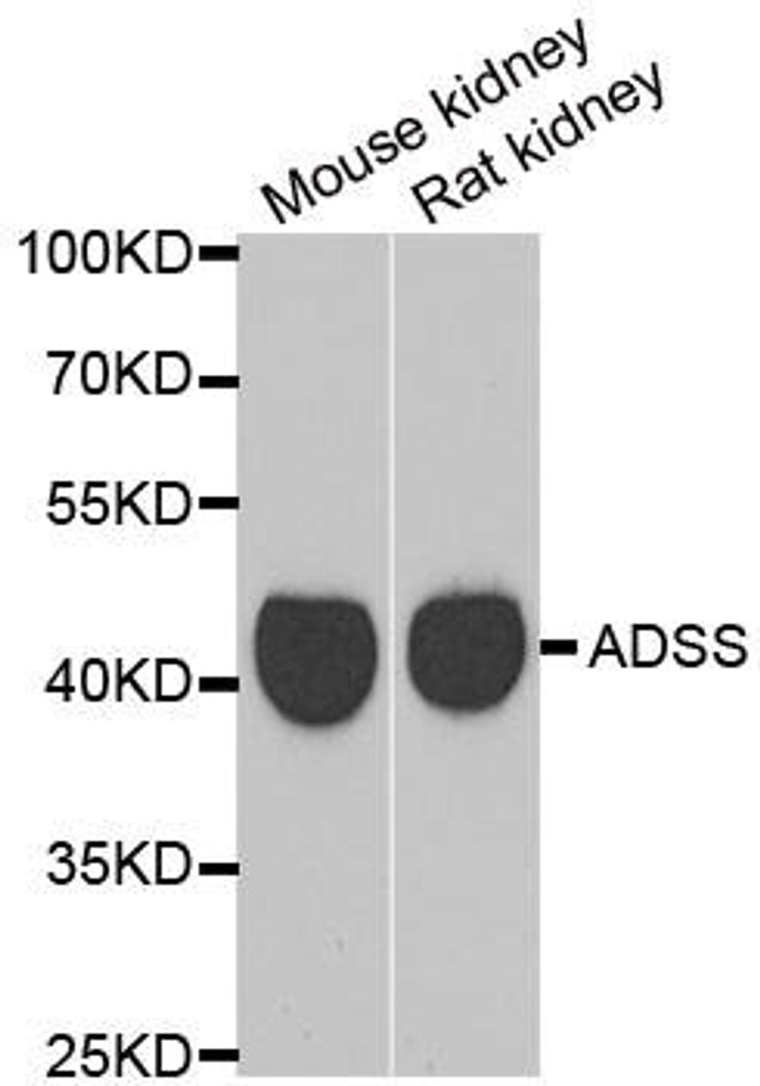 Western blot analysis of extracts of various cell lines using GATM antibody