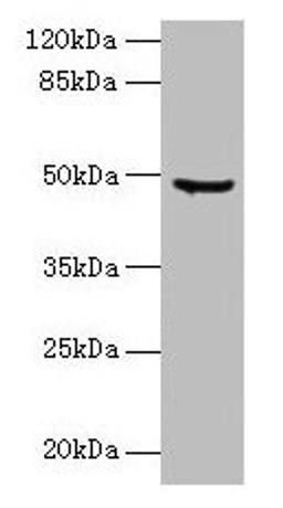 Western blot. All lanes: CPA2 antibody at 1.5µg/ml + Hela whole cell lysate. Secondary. Goat polyclonal to rabbit IgG at 1/10000 dilution. Predicted band size: 48 kDa. Observed band size: 48 kDa