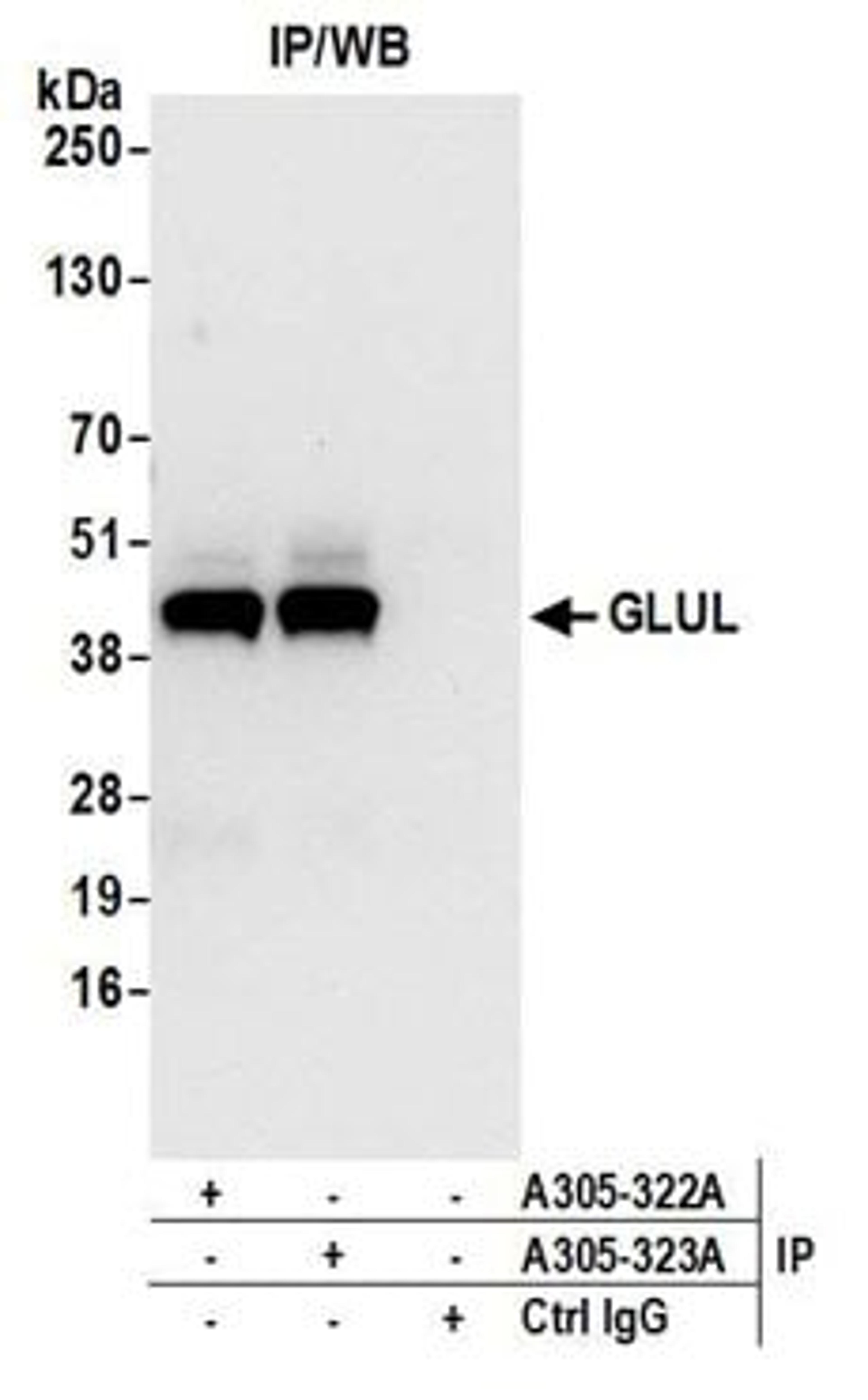 Detection of human GLUL by western blot of immunoprecipitates.