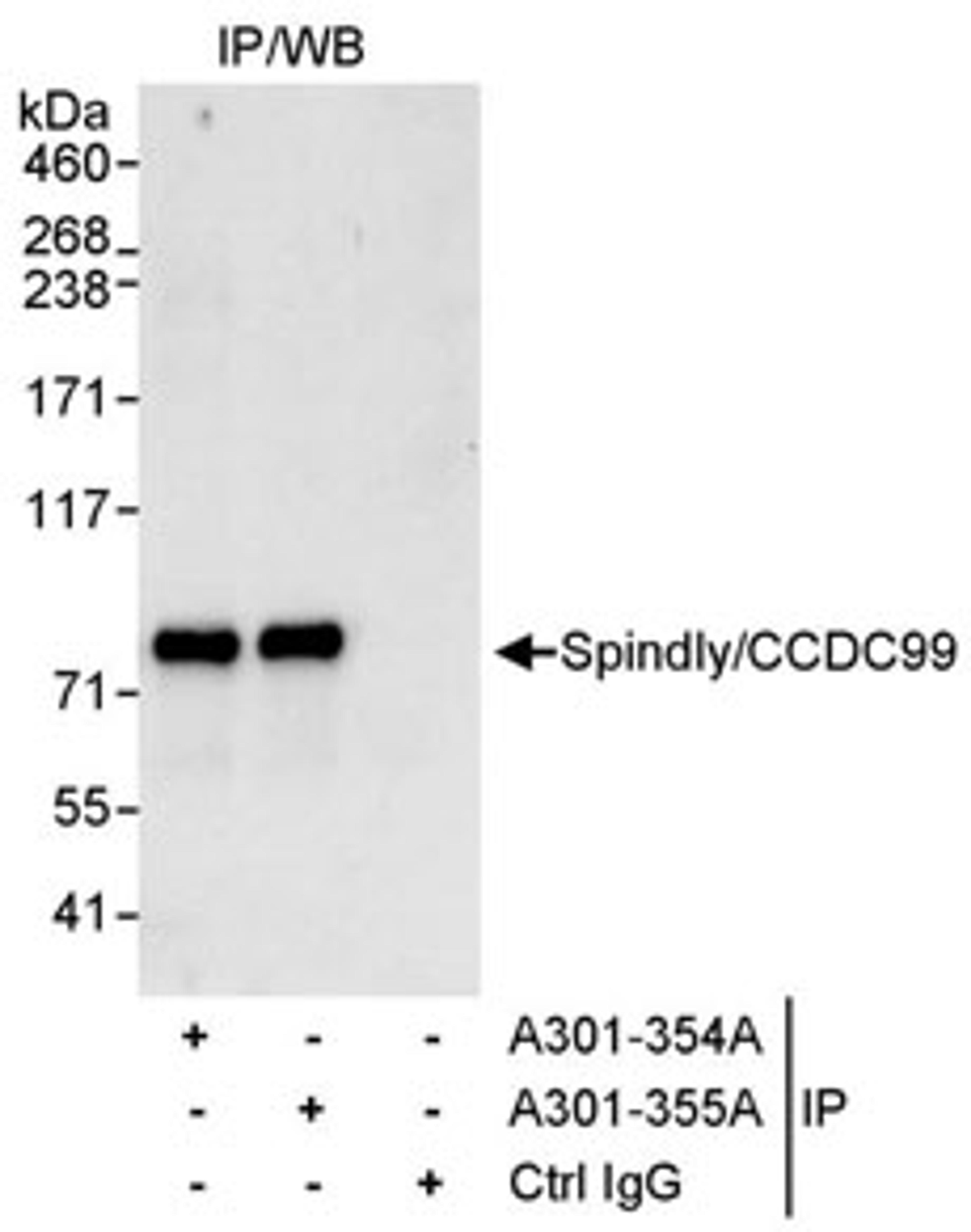 Detection of human Spindly/CCDC99 by western blot of immunoprecipitates.