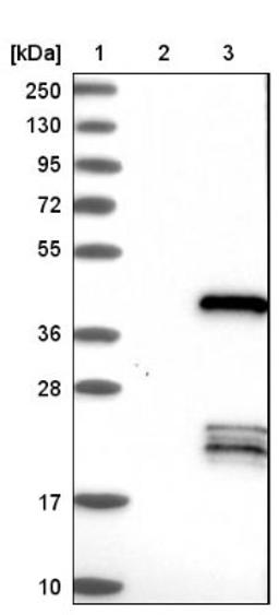 Western Blot: C/EBP epsilon Antibody [NBP1-85446] - Lane 1: Marker [kDa] 250, 130, 95, 72, 55, 36, 28, 17, 10<br/>Lane 2: Negative control (vector only transfected HEK293T lysate)<br/>Lane 3: Over-expression lysate (Co-expressed with a C-terminal myc-DDK tag (~3.1 kDa) in mammalian HEK293T cells, LY400685)