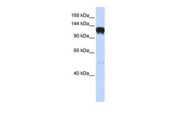 Antibody used in WB on Human Brain at 0.2-1 ug/ml.