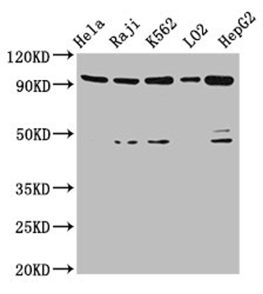 Western Blot. Positive WB detected in: Hela whole cell lysate, Raji whole cell lysate, K562 whole cell lysate, LO2 whole cell lysate, HepG2 whole cell lysate. All lanes: PROM1 antibody at 4.8ug/ml. Secondary. Goat polyclonal to rabbit IgG at 1/50000 dilution. Predicted band size: 98, 97, 94, 93, 95 kDa. Observed band size: 98 kDa. 