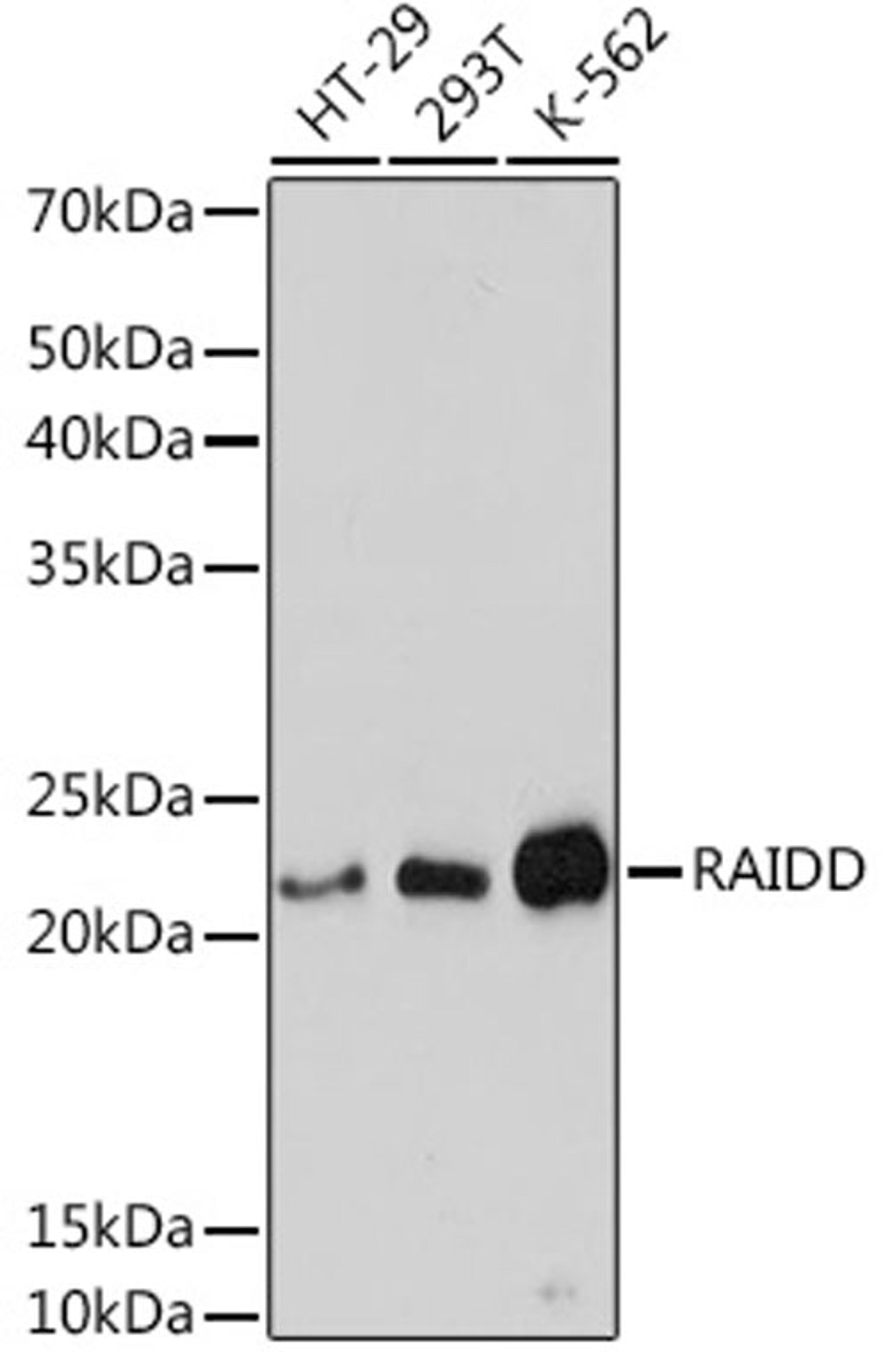 Western blot - RAIDD Rabbit mAb (A8663)