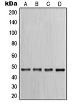 Western blot analysis of PC12 (Lane 1), HeLa (Lane 2), A431 (Lane 3), NIH3T3 (Lane 4) whole cell lysates using KRT17 antibody