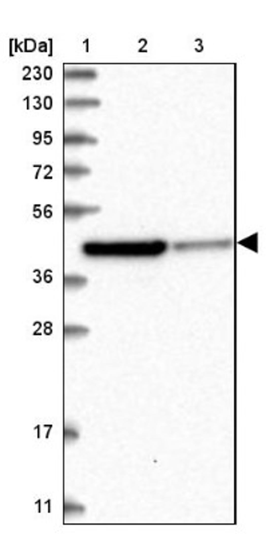 Western Blot: RTKN Antibody [NBP1-88956] - Lane 1: Marker [kDa] 230, 130, 95, 72, 56, 36, 28, 17, 11<br/>Lane 2: Human cell line RT-4<br/>Lane 3: Human cell line U-251MG sp