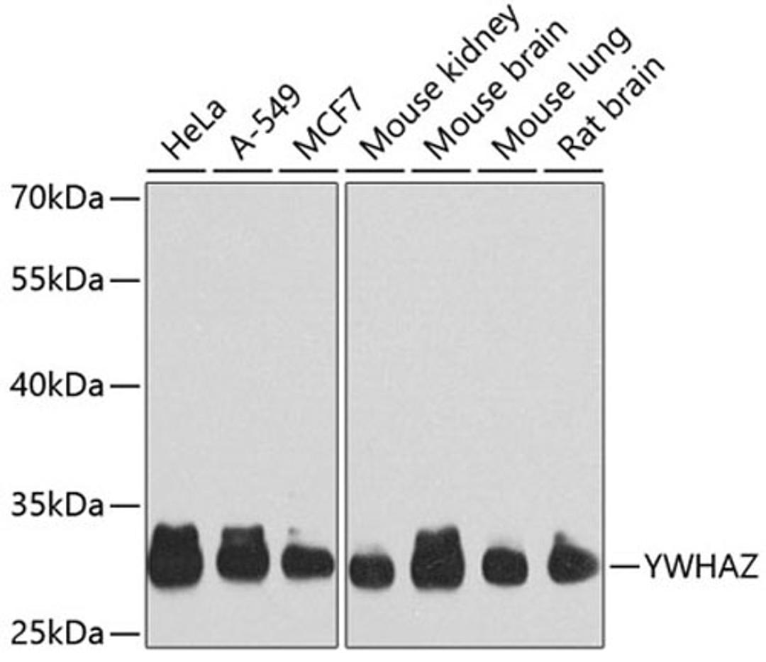 Western blot - YWHAZ Antibody (A7639)