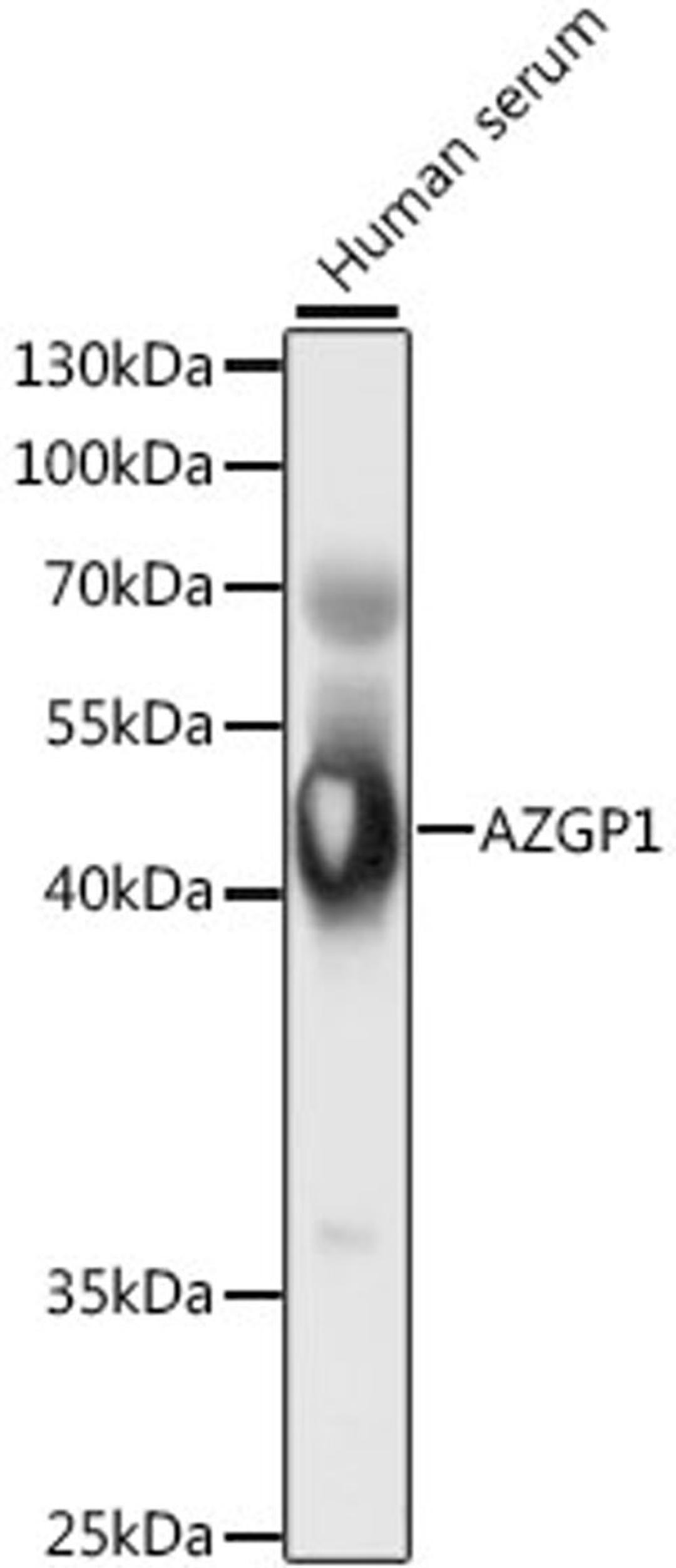 Western blot - AZGP1 antibody (A5365)