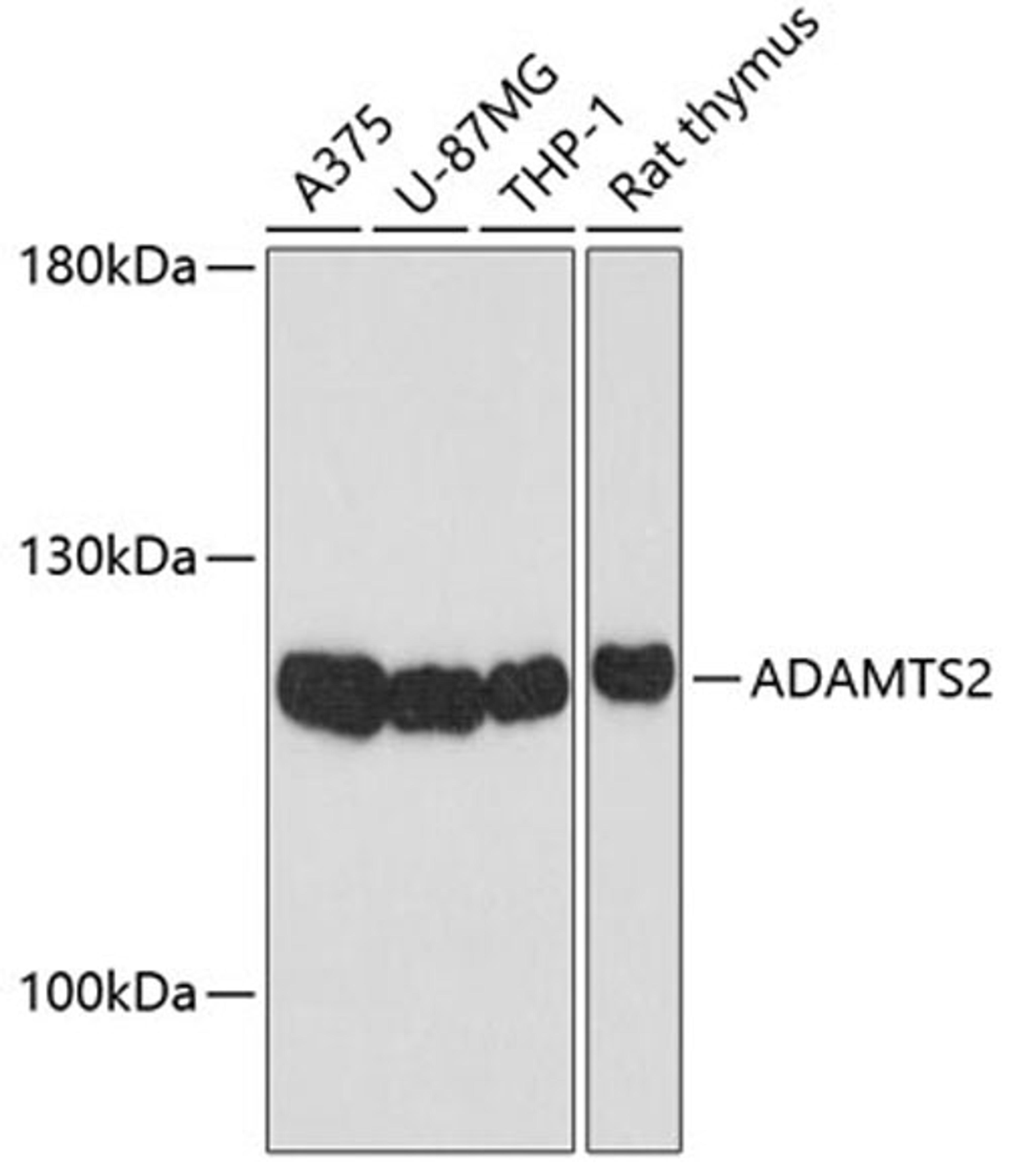 Western blot - ADAMTS2 Antibody (A10272)