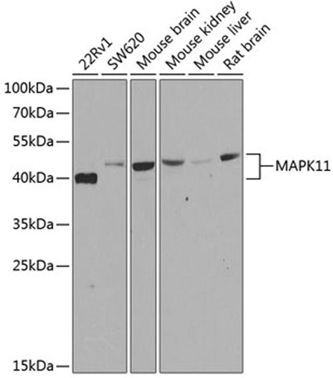 Western blot - MAPK11 antibody (A7717)