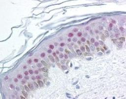 Immunohistochemistry-Paraffin: Nucleophosmin [p Thr234, p Thr237] Antibody [NB100-78399] - Formalin-fixed paraffin-embedded human epidermis tissue was stained with Poly6191 and developed with an alkaline phosphatase chromogen substate (red color). Tissue was counterstained with H&E (blue/pink). Magnification, 40X.